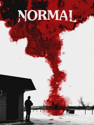 Normal